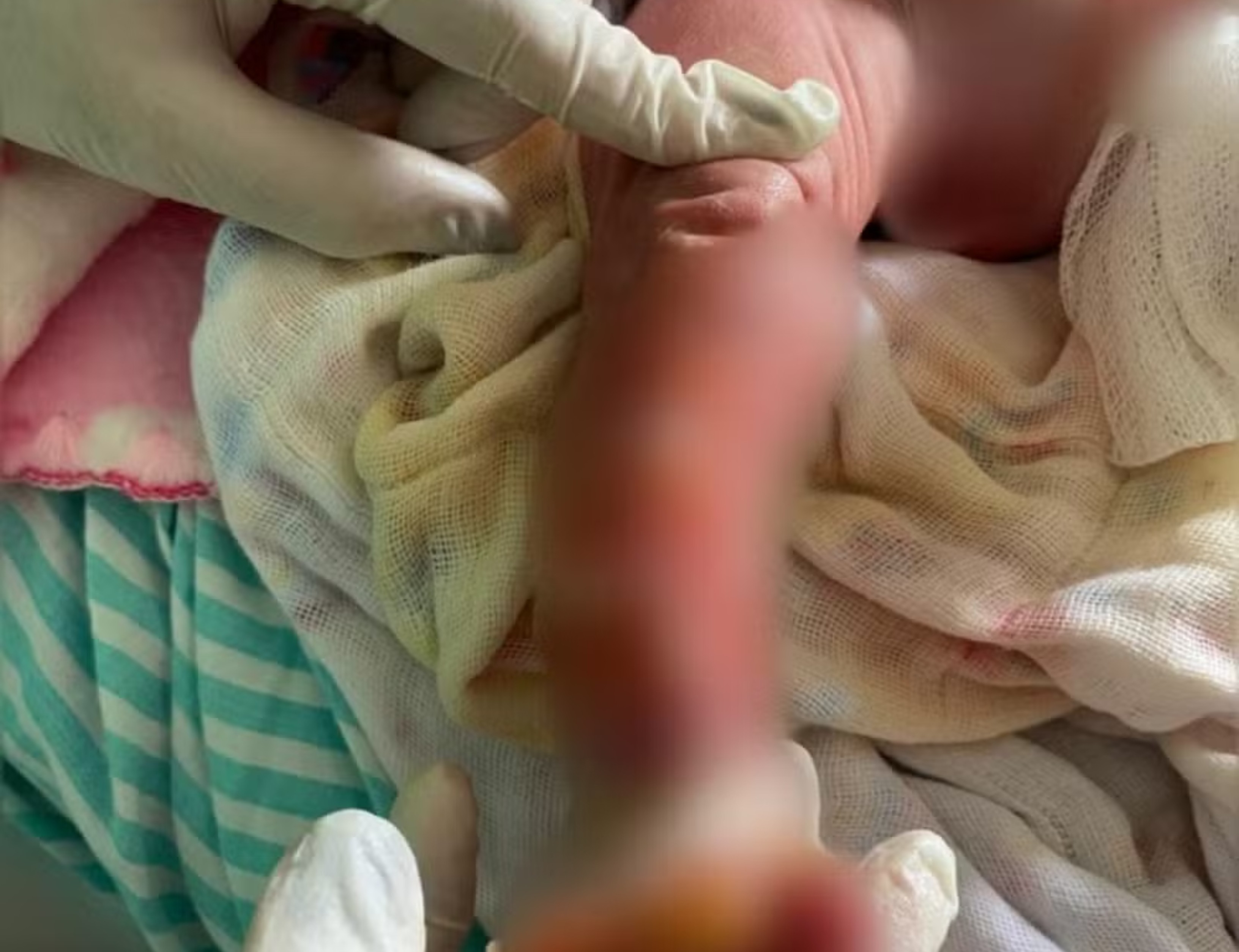 Caso Aurora: recém-nascida internada na UTI após banho passa por exames em hospital de MG