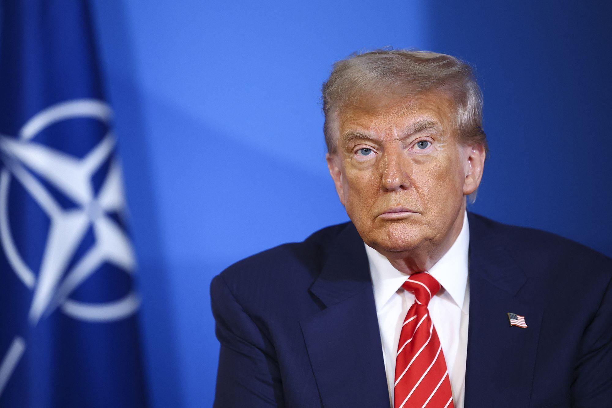 Trump diz que fará anúncio “importante” sobre autismo nesta segunda