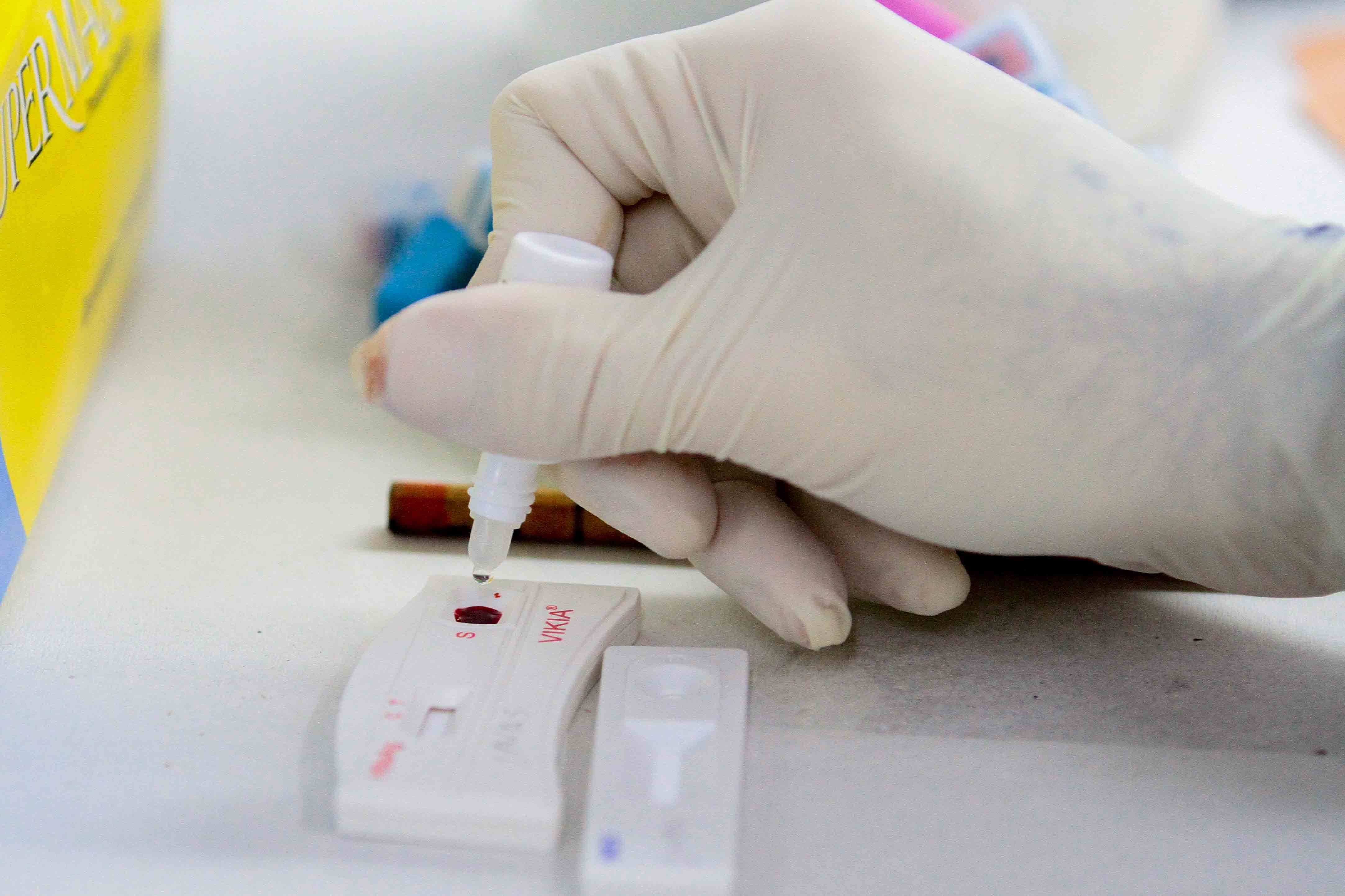 Casos de hepatite em Juiz de Fora: saiba os sintomas, como tratar e quem pode se vacinar