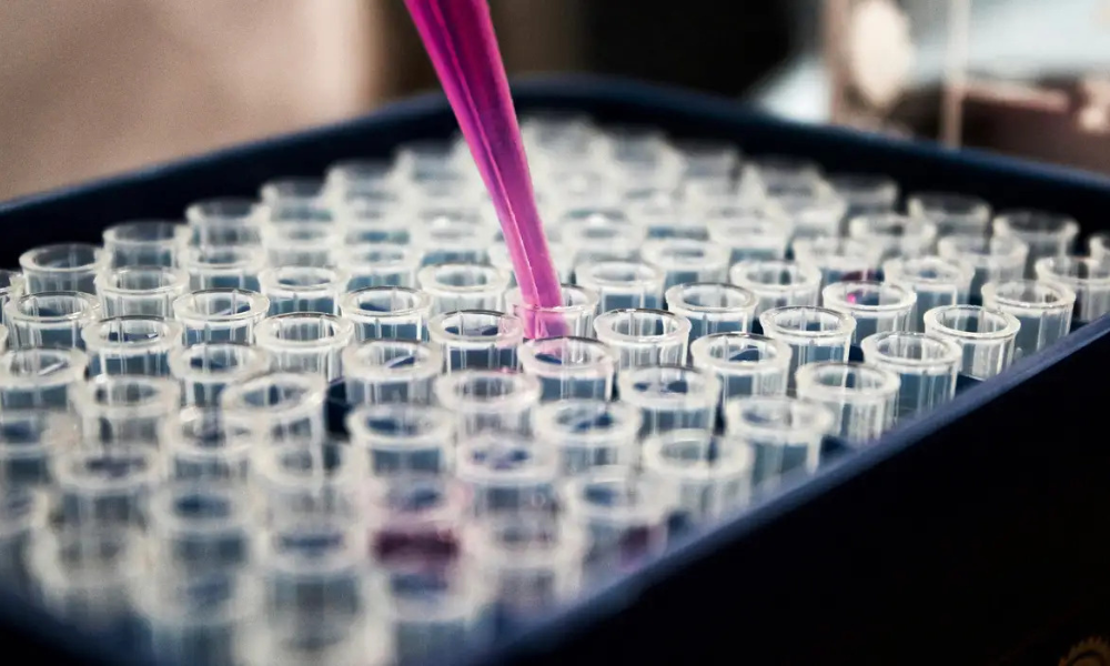 Exame de sangue promete transformar diagnóstico do Alzheimer, mas não é para todos